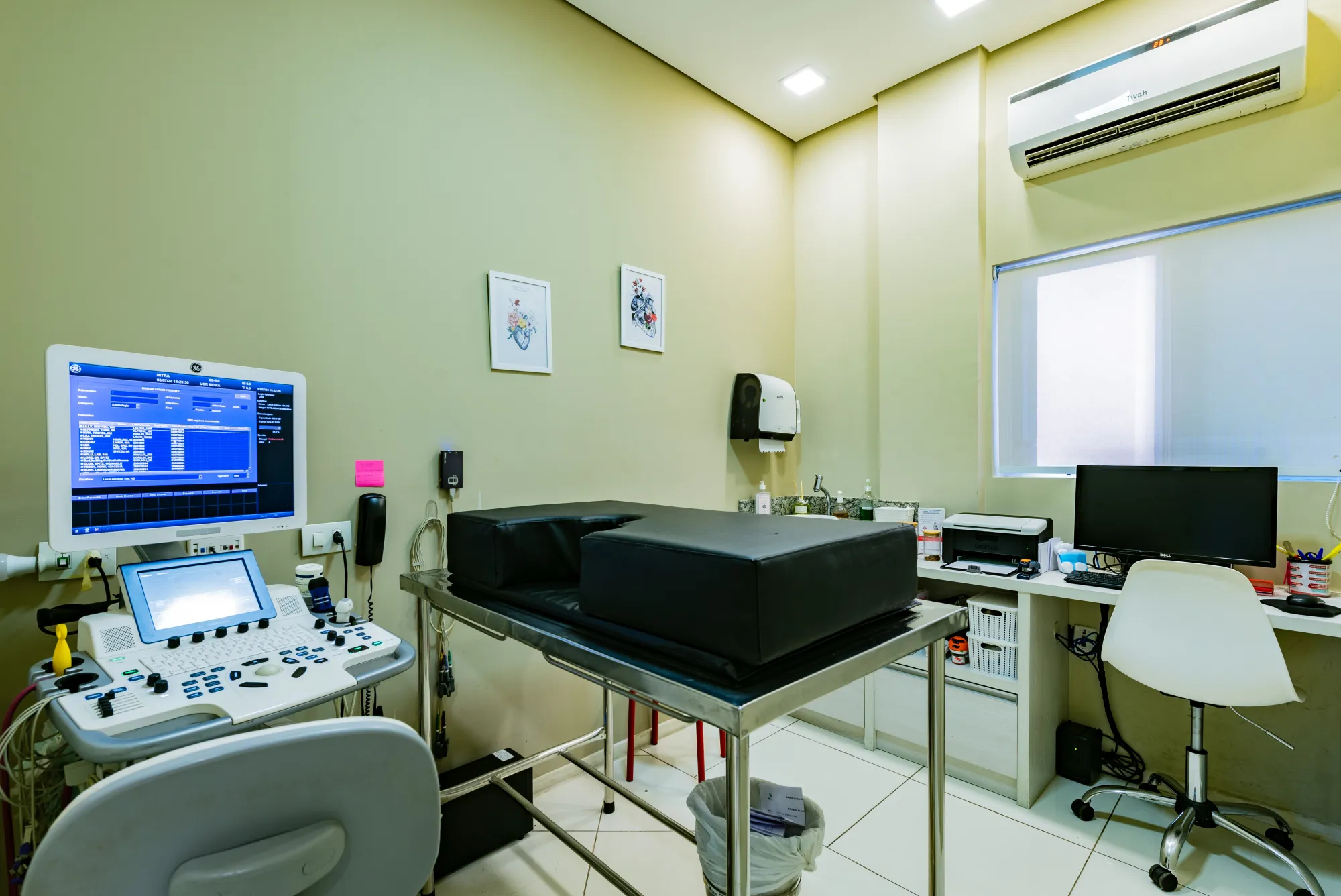 Sala de ultrassonografia com aparelho e monitores