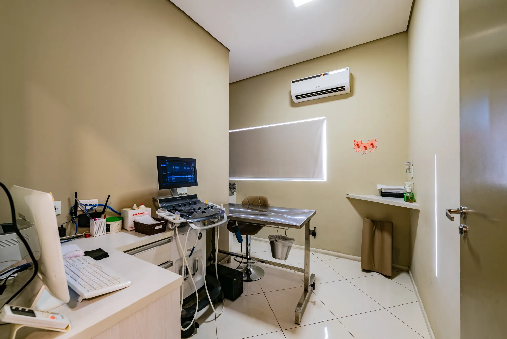 Sala de exame de ultrassom do Ômega